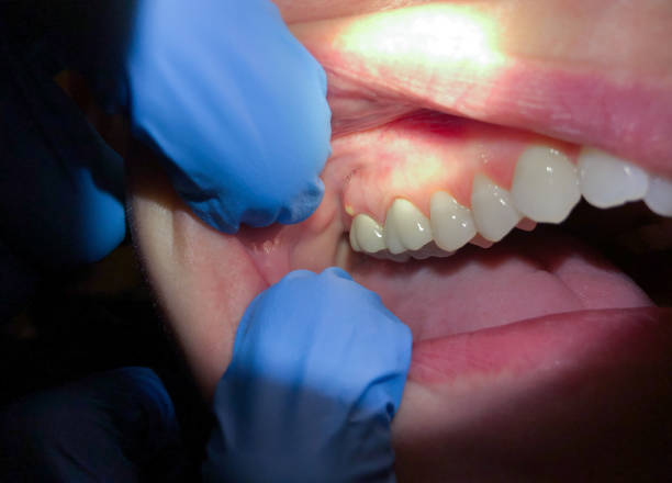Best 24-Hour Emergency Dental Care in Savannah, TX
